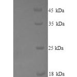 SDS-PAGE separation of QP8231 followed by commassie total protein stain results in a primary band consistent with reported data for Methionine synthase reductase. These data demonstrate Greater than 90% as determined by SDS-PAGE.