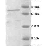 SDS-PAGE separation of QP8246 followed by commassie total protein stain results in a primary band consistent with reported data for Adamts7. These data demonstrate Greater than 90% as determined by SDS-PAGE.