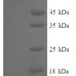 SDS-PAGE separation of QP8264 followed by commassie total protein stain results in a primary band consistent with reported data for Myotubularin-related protein 7. These data demonstrate Greater than 90% as determined by SDS-PAGE.