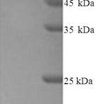 SDS-PAGE separation of QP8266 followed by commassie total protein stain results in a primary band consistent with reported data for Protein-arginine deiminase type-2. These data demonstrate Greater than 90% as determined by SDS-PAGE.