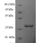 SDS-PAGE separation of QP8270 followed by commassie total protein stain results in a primary band consistent with reported data for TIMM10B. These data demonstrate Greater than 90% as determined by SDS-PAGE.