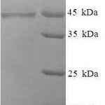 SDS-PAGE separation of QP8273 followed by commassie total protein stain results in a primary band consistent with reported data for COLEC10. These data demonstrate Greater than 90% as determined by SDS-PAGE.