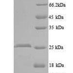 SDS-PAGE separation of QP8274 followed by commassie total protein stain results in a primary band consistent with reported data for WNT1-inducible-signaling pathway protein 2. These data demonstrate Greater than 90% as determined by SDS-PAGE.