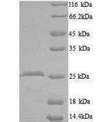 SDS-PAGE separation of QP8274 followed by commassie total protein stain results in a primary band consistent with reported data for WNT1-inducible-signaling pathway protein 2. These data demonstrate Greater than 90% as determined by SDS-PAGE.