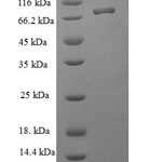 SDS-PAGE separation of QP8278 followed by commassie total protein stain results in a primary band consistent with reported data for Nucleolar protein 58. These data demonstrate Greater than 90% as determined by SDS-PAGE.