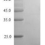 SDS-PAGE separation of QP8282 followed by commassie total protein stain results in a primary band consistent with reported data for Centrosomal protein of 83 kDa. These data demonstrate Greater than 90% as determined by SDS-PAGE.