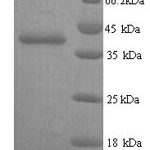 SDS-PAGE separation of QP8291 followed by commassie total protein stain results in a primary band consistent with reported data for Talin-2. These data demonstrate Greater than 90% as determined by SDS-PAGE.