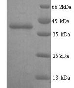 SDS-PAGE separation of QP8291 followed by commassie total protein stain results in a primary band consistent with reported data for Talin-2. These data demonstrate Greater than 90% as determined by SDS-PAGE.