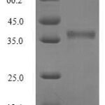 SDS-PAGE separation of QP8301 followed by commassie total protein stain results in a primary band consistent with reported data for Oncostatin M / OSM. These data demonstrate Greater than 90% as determined by SDS-PAGE.