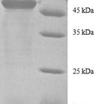 SDS-PAGE separation of QP8331 followed by commassie total protein stain results in a primary band consistent with reported data for 40S ribosomal protein S9. These data demonstrate Greater than 90% as determined by SDS-PAGE.