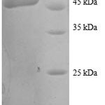 SDS-PAGE separation of QP8335 followed by commassie total protein stain results in a primary band consistent with reported data for Transgelin. These data demonstrate Greater than 90% as determined by SDS-PAGE.