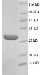 SDS-PAGE separation of QP8343 followed by commassie total protein stain results in a primary band consistent with reported data for Integrin-linked protein kinase. These data demonstrate Greater than 90% as determined by SDS-PAGE.
