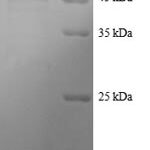 SDS-PAGE separation of QP8348 followed by commassie total protein stain results in a primary band consistent with reported data for Tetratricopeptide repeat protein 1. These data demonstrate Greater than 90% as determined by SDS-PAGE.