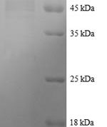 SDS-PAGE separation of QP8348 followed by commassie total protein stain results in a primary band consistent with reported data for Tetratricopeptide repeat protein 1. These data demonstrate Greater than 90% as determined by SDS-PAGE.