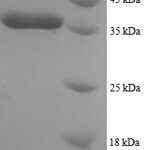 SDS-PAGE separation of QP8357 followed by commassie total protein stain results in a primary band consistent with reported data for Dynein light chain 1