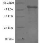 SDS-PAGE separation of QP8361 followed by commassie total protein stain results in a primary band consistent with reported data for Proteasome subunit alpha type-7. These data demonstrate Greater than 90% as determined by SDS-PAGE.