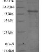 SDS-PAGE separation of QP8361 followed by commassie total protein stain results in a primary band consistent with reported data for Proteasome subunit alpha type-7. These data demonstrate Greater than 90% as determined by SDS-PAGE.