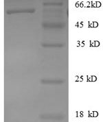 SDS-PAGE separation of QP8416 followed by commassie total protein stain results in a primary band consistent with reported data for Heterogeneous nuclear ribonucleoprotein D0. These data demonstrate Greater than 90% as determined by SDS-PAGE.