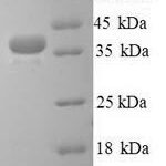 SDS-PAGE separation of QP8498 followed by commassie total protein stain results in a primary band consistent with reported data for Talin-1. These data demonstrate Greater than 90% as determined by SDS-PAGE.