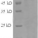 SDS-PAGE separation of QP8512 followed by commassie total protein stain results in a primary band consistent with reported data for Angiopoietin-2 / ANG2. These data demonstrate Greater than 90% as determined by SDS-PAGE.