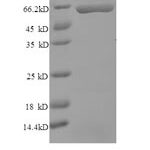 SDS-PAGE separation of QP8517 followed by commassie total protein stain results in a primary band consistent with reported data for Carbonic Anhydrase IX. These data demonstrate Greater than 90% as determined by SDS-PAGE.