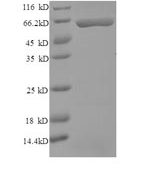SDS-PAGE separation of QP8517 followed by commassie total protein stain results in a primary band consistent with reported data for Carbonic Anhydrase IX. These data demonstrate Greater than 90% as determined by SDS-PAGE.
