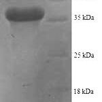 SDS-PAGE separation of QP8519 followed by commassie total protein stain results in a primary band consistent with reported data for CCL2 / MCP-1 / MCP1. These data demonstrate Greater than 90% as determined by SDS-PAGE.