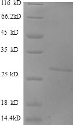 SDS-PAGE separation of QP8536 followed by commassie total protein stain results in a primary band consistent with reported data for DKK-1 / Dkk1. These data demonstrate Greater than 90% as determined by SDS-PAGE.