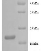 SDS-PAGE separation of QP8545 followed by commassie total protein stain results in a primary band consistent with reported data for G-CSF / CSF3. These data demonstrate Greater than 90% as determined by SDS-PAGE.
