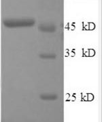SDS-PAGE separation of QP8547 followed by commassie total protein stain results in a primary band consistent with reported data for IFNB1 / IFN-beta / Interferon beta. These data demonstrate Greater than 90% as determined by SDS-PAGE.