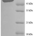 SDS-PAGE separation of QP8554 followed by commassie total protein stain results in a primary band consistent with reported data for Interleukin-12 subunit beta. These data demonstrate Greater than 90% as determined by SDS-PAGE.