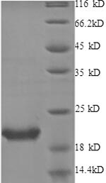 SDS-PAGE separation of QP8556 followed by commassie total protein stain results in a primary band consistent with reported data for IL-1RA / IL1RN. These data demonstrate Greater than 90% as determined by SDS-PAGE.