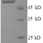 SDS-PAGE separation of QP8562 followed by commassie total protein stain results in a primary band consistent with reported data for Cathepsin B / CTSB. These data demonstrate Greater than 90% as determined by SDS-PAGE.