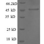 SDS-PAGE separation of QP8564 followed by commassie total protein stain results in a primary band consistent with reported data for MMP1. These data demonstrate Greater than 90% as determined by SDS-PAGE.