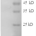 SDS-PAGE separation of QP8565 followed by commassie total protein stain results in a primary band consistent with reported data for CD54 / ICAM-1. These data demonstrate Greater than 90% as determined by SDS-PAGE.