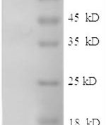 SDS-PAGE separation of QP8565 followed by commassie total protein stain results in a primary band consistent with reported data for CD54 / ICAM-1. These data demonstrate Greater than 90% as determined by SDS-PAGE.