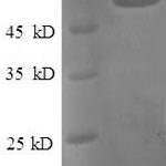 SDS-PAGE separation of QP8567 followed by commassie total protein stain results in a primary band consistent with reported data for Tissue factor pathway inhibitor. These data demonstrate Greater than 90% as determined by SDS-PAGE.