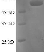 SDS-PAGE separation of QP8567 followed by commassie total protein stain results in a primary band consistent with reported data for Tissue factor pathway inhibitor. These data demonstrate Greater than 90% as determined by SDS-PAGE.