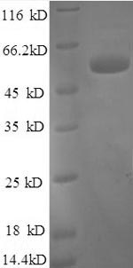 SDS-PAGE separation of QP8567 followed by commassie total protein stain results in a primary band consistent with reported data for Tissue factor pathway inhibitor. These data demonstrate Greater than 90% as determined by SDS-PAGE.