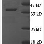 SDS-PAGE separation of QP8570 followed by commassie total protein stain results in a primary band consistent with reported data for Thrombospondin-1. These data demonstrate Greater than 90% as determined by SDS-PAGE.