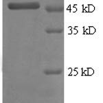 SDS-PAGE separation of QP8571 followed by commassie total protein stain results in a primary band consistent with reported data for TIMP2 / TIMP-2. These data demonstrate Greater than 90% as determined by SDS-PAGE.