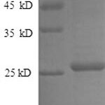 SDS-PAGE separation of QP8572 followed by commassie total protein stain results in a primary band consistent with reported data for Metalloproteinase inhibitor 4. These data demonstrate Greater than 90% as determined by SDS-PAGE.