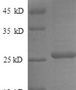 SDS-PAGE separation of QP8572 followed by commassie total protein stain results in a primary band consistent with reported data for Metalloproteinase inhibitor 4. These data demonstrate Greater than 90% as determined by SDS-PAGE.