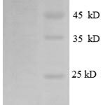 SDS-PAGE separation of QP8574 followed by commassie total protein stain results in a primary band consistent with reported data for CD171 / N-CAML1 / L1CAM. These data demonstrate Greater than 90% as determined by SDS-PAGE.