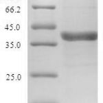 SDS-PAGE separation of QP8577 followed by commassie total protein stain results in a primary band consistent with reported data for VEGF-C. These data demonstrate Greater than 90% as determined by SDS-PAGE.