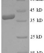 SDS-PAGE separation of QP8578 followed by commassie total protein stain results in a primary band consistent with reported data for Vascular endothelial growth factor D. These data demonstrate Greater than 90% as determined by SDS-PAGE.