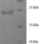 SDS-PAGE separation of QP8580 followed by commassie total protein stain results in a primary band consistent with reported data for IGF1 / IGF-I. These data demonstrate Greater than 90% as determined by SDS-PAGE.