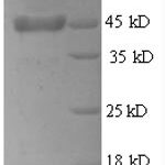 SDS-PAGE separation of QP8583 followed by commassie total protein stain results in a primary band consistent with reported data for Thrombopoietin / THPO. These data demonstrate Greater than 90% as determined by SDS-PAGE.