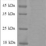 SDS-PAGE separation of QP8584 followed by commassie total protein stain results in a primary band consistent with reported data for HSPD1 / HSP60. These data demonstrate Greater than 90% as determined by SDS-PAGE.