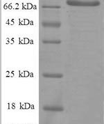 SDS-PAGE separation of QP8584 followed by commassie total protein stain results in a primary band consistent with reported data for HSPD1 / HSP60. These data demonstrate Greater than 90% as determined by SDS-PAGE.